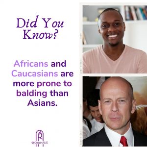 Africans and Caucasians are more prone to balding than Asians.