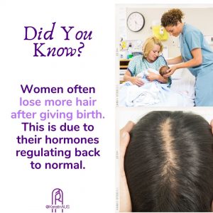 Women often lose more hair after giving birth. Holing a baby