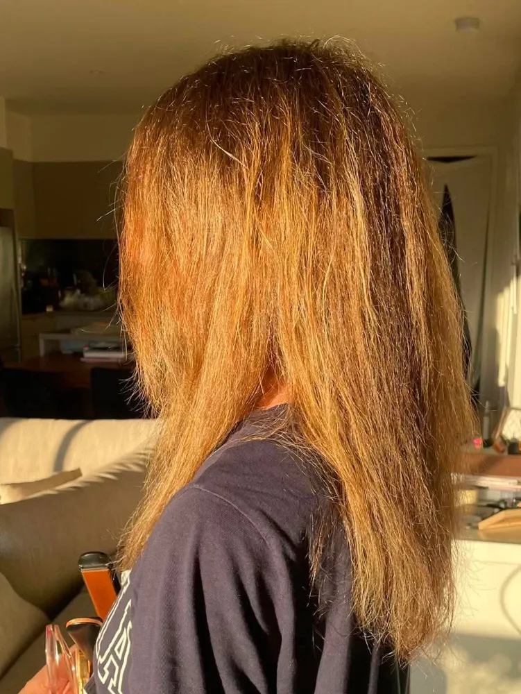Side view of Jane’s hair before treatment