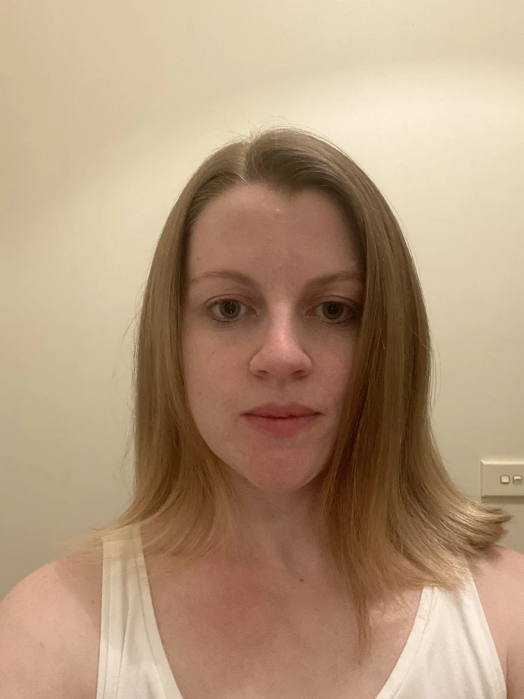 Front view of Tegan’s hair after treatment