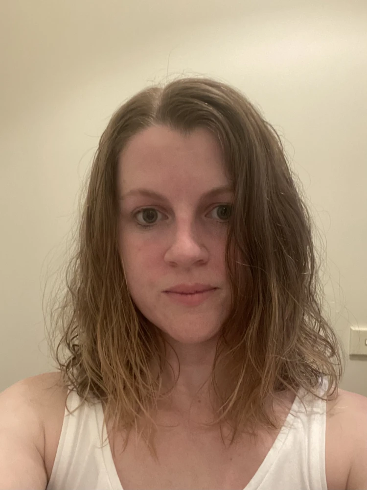 Front view of Tegan’s hair before treatment